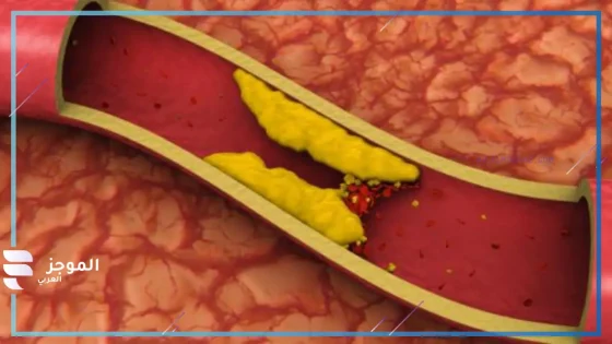 طريقة الحفاظ على المستوى الطبيعي للكوليستيرول في الدم