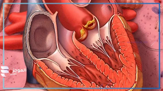 التهاب القلب المعدي … الأسباب والأعراض وطرق العلاج