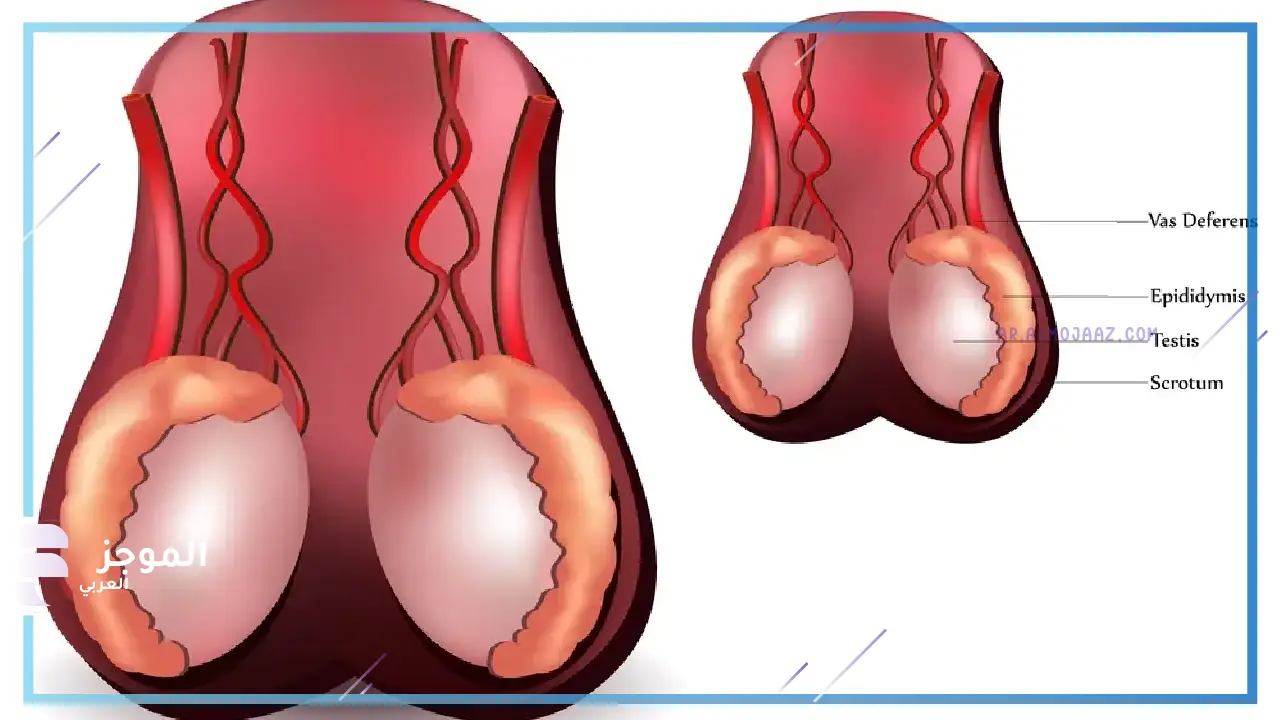 كيف يتم تشخيص التواء الخصية للرضيع